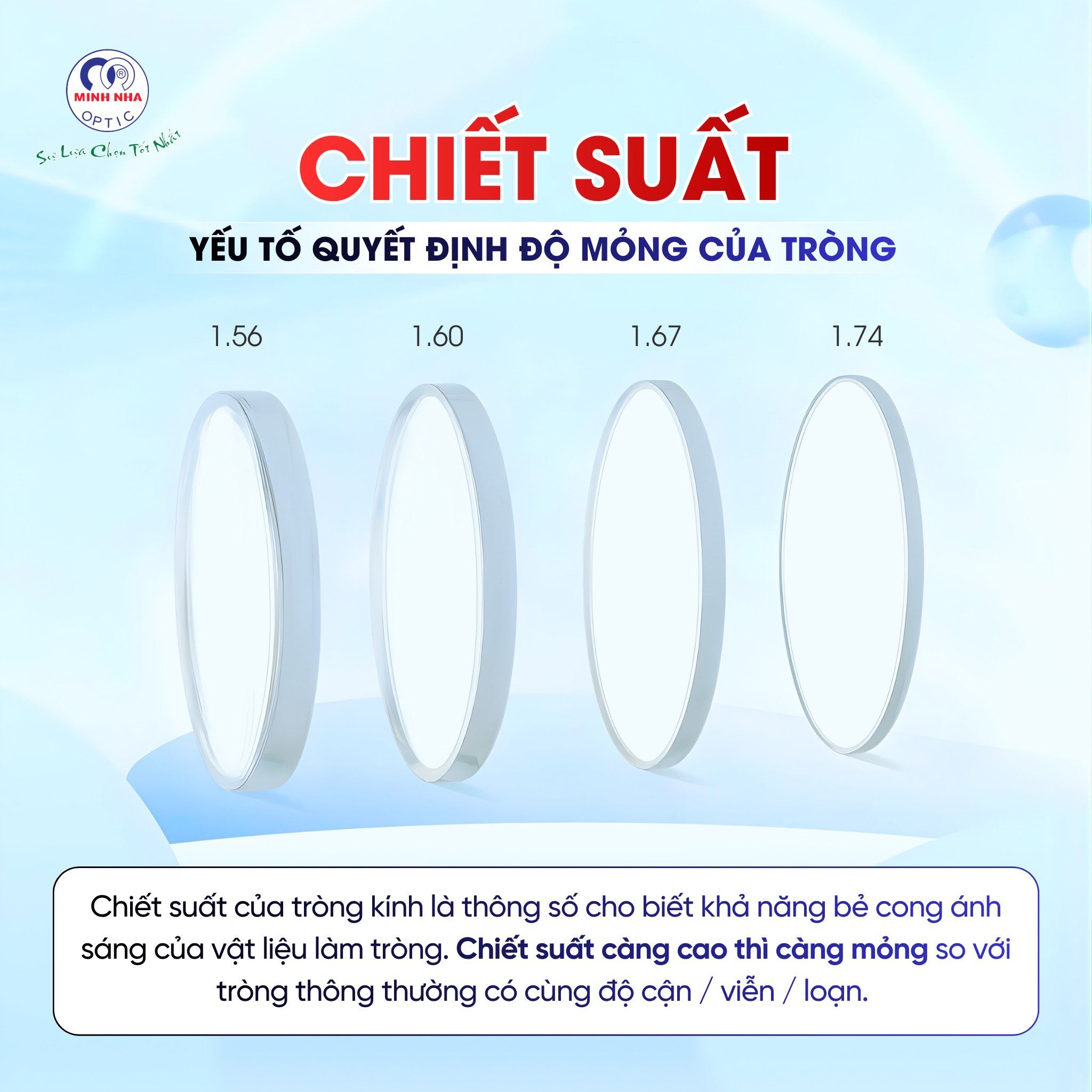 TẠM BIỆT NỖI LO KÍNH DÀY – TỰ TIN VỚI TRÒNG SIÊU MỎNG | MẮT KÍNH MINH NHÃ PHAN THIẾT